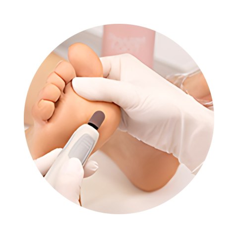PHARM FOOT KERATOSIS exTerminator Żel Silnie Zmiękczający Do Stóp 300ml PHARM FOOT KERATOSIS exTerminator Żel Silnie Zmiękczający Do Stóp 300ml